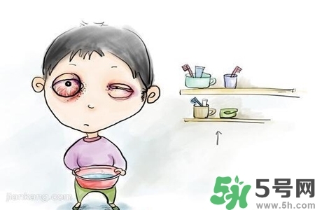 寶寶為什么會(huì)感染紅眼??？寶寶患紅眼病如何治療？
