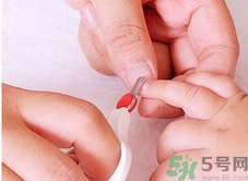 寶寶長(zhǎng)蘚是怎么回事？寶寶長(zhǎng)蘚怎么辦？