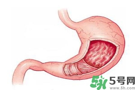 急性腸胃炎哪些食物不可以吃？急性腸胃炎不能吃的水果有？