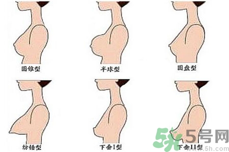 胸部松弛的原因是什么？胸部松弛該怎么辦？