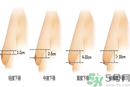 胸部松弛的原因是什么？胸部松弛該怎么辦？