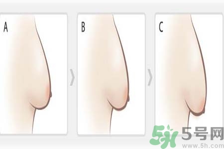 如何預(yù)防胸部松弛？吃什么能使胸部挺拔？
