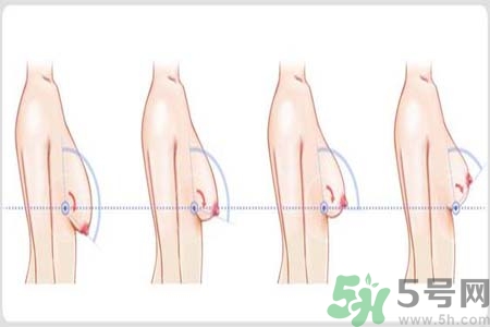 如何預(yù)防胸部松弛？吃什么能使胸部挺拔？