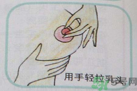 乳頭內(nèi)陷怎么回事？乳頭內(nèi)陷的原因是什么？
