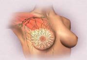 乳頭發(fā)黑是怎么回事？乳頭發(fā)黑是什么原因？