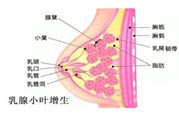 乳腺增生治療方法是什么？乳腺增生的檢查方法有哪些？