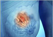 乳房有硬塊正常嗎？乳房有腫塊怎么回事？