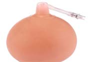 乳頭內(nèi)陷可以拔罐嗎？乳頭內(nèi)陷需要手術(shù)治療嗎？