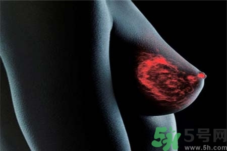 乳房上有硬塊怎么辦？乳房有硬塊的病因是什么？