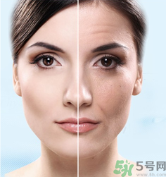 什么是3D液態(tài)拉皮？3D液態(tài)拉皮效果怎么樣？