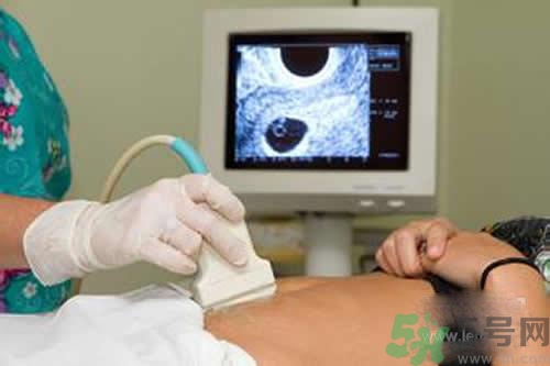 孕婦做b超要空腹嗎？孕婦做b超要不要空腹？