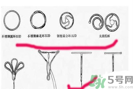 什么是宮內(nèi)節(jié)育器？放置宮內(nèi)節(jié)育器為什么能避孕？