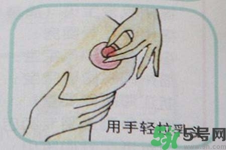 乳頭內(nèi)陷怎么矯正？乳頭內(nèi)陷矯正方法是什么？