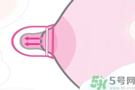 乳頭內(nèi)陷能不能喂奶？乳頭凹陷怎樣哺乳？
