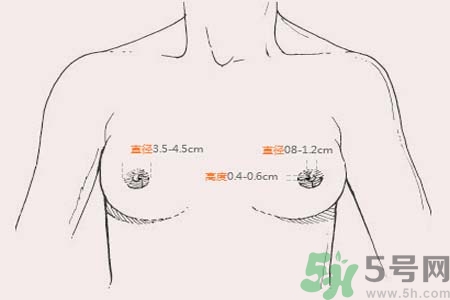 乳頭內(nèi)陷能不能喂奶？乳頭凹陷怎樣哺乳？