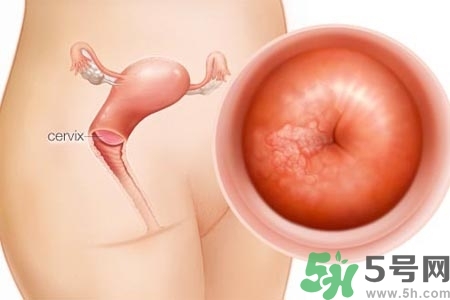陰道干澀是什么？陰道干澀的危害有什么？