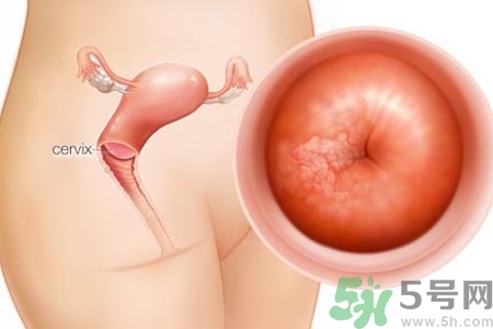 陰道干澀的原因是什么？陰道干澀怎么辦？