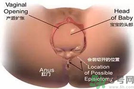 女性陰道松弛的原因是什么？女性陰道松弛怎么辦？