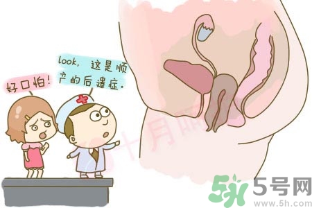 陰道松弛是什么？陰道松弛的癥狀有哪些？