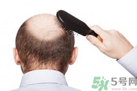 男性衰老的年齡段是什么？各年齡段男性抗衰老法則