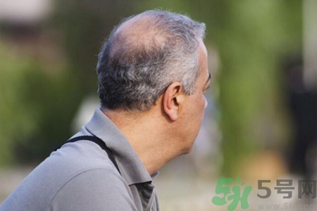 男性衰老的征兆有哪些？男性10個(gè)難以逆轉(zhuǎn)的衰老征兆
