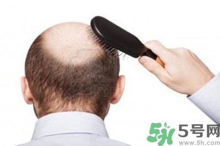 男性防止性衰老決竅有哪些？男性受用一生抵抗衰老法則