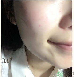 麗得姿面膜適合孕婦可以用嗎？麗得姿面膜哪些孕婦可以用？