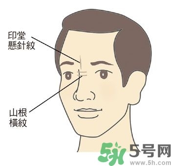 耳垂上有豎紋是怎么回事？山根有橫紋是什么?。?></p><h3>山根</h3><p>鼻尖是臉部最高的部位，就像山峰一樣，而位於兩眼內(nèi)側(cè)眼頭之間的鼻梁低處，是鼻子開始要隆起的地方，相對(duì)於鼻子高度最低，所以稱為「山根」，它與心臟關(guān)系最密切。正常的山根，高度應(yīng)該與鼻子和面部的比例相合，而且要有隆起的樣子，光滑無橫紋，沒有青筋。</p><p>許多壯年猝死的人，如人稱科技游俠的溫世仁先生（腦干出血），藝人戎祥、馬兆駿（心肌梗塞）等，他們的山根都比較低陷，幾乎與兩側(cè)的眼頭一樣高。</p><p>●山根低陷或出現(xiàn)橫向細(xì)紋：山根低陷除非是外傷，否則通常是先天的結(jié)構(gòu)；山根橫紋則常在身體使用多年、身心壓力大的中年以後出現(xiàn)，而且多兼有皺眉的習(xí)慣。</p><p>●山根青筋：較常出現(xiàn)在小孩子身上，表示曾受驚嚇，心神不安，睡覺時(shí)多會(huì)翻覆，情緒比較不太穩(wěn)定。</p><p style=