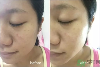 rilastil面膜使用方法 維納斯蒂爾面膜怎么用？