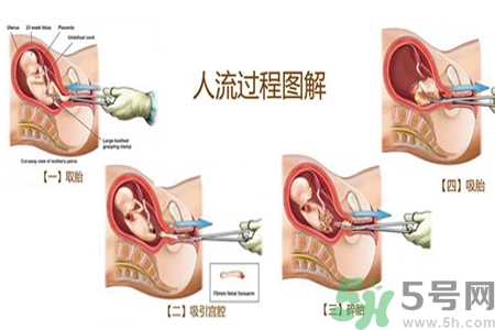 人流后怎么調(diào)養(yǎng)身體？人流后飲食需注意什么？