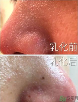 嬌韻詩(shī)吸盤潔面用法圖 嬌韻詩(shī)吸盤使用方法