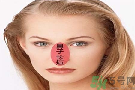 鼻子兩側(cè)長(zhǎng)痘怎么辦？鼻子兩側(cè)長(zhǎng)痘怎么回事？