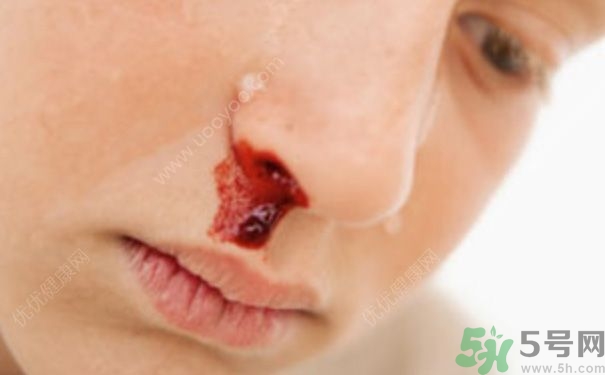 15歲男孩可以刮胡子嗎？15歲男孩經(jīng)常流鼻血怎么回事？