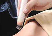 肩周炎艾灸有用嗎？肩周炎艾灸哪些部位？