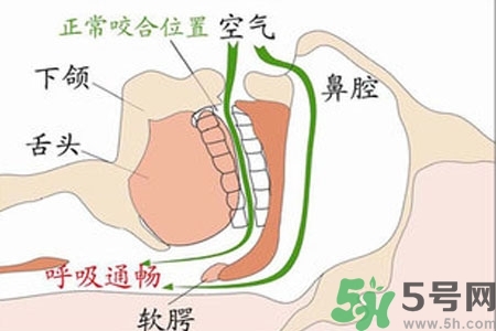 鼻子紅是什么原因？鼻子紅怎么辦？