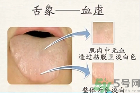 血虛的癥狀是什么？血虛的表現(xiàn)有哪些？