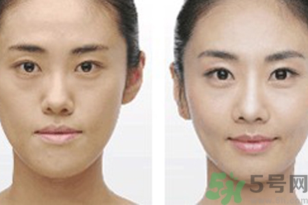 激光縮毛孔多少錢一次？激光縮毛孔一個療程多少錢？