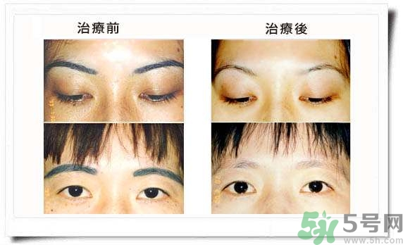 紋眉毛有什么危害？紋眉后注意事項(xiàng)