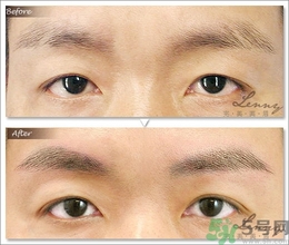 眉毛怎么整形好看？眉毛怎么整自然？