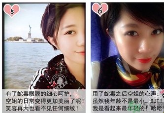 蛇毒眼膜孕婦可以用嗎？ 日本spa蛇毒眼膜孕婦能用嗎？