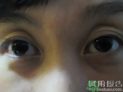蛇毒眼膜效果怎么樣？spa蛇毒眼膜紅色好用嗎？