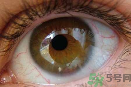 ?干眼癥的治療方法是什么？如何預(yù)防干眼癥？