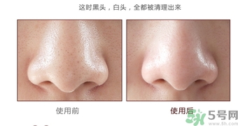 yu.r巧克力棒鼻貼怎么樣？yu.r巧克力鼻貼好用嗎？