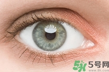 黑眼圈是怎么形成的？黑眼圈是什么原因引起的？
