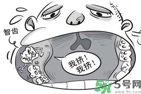 智齒橫著長怎么辦？智齒橫著長一定要拔了嗎？