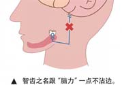 長(zhǎng)智齒疼痛怎么辦？長(zhǎng)智齒牙齦腫了怎么辦？