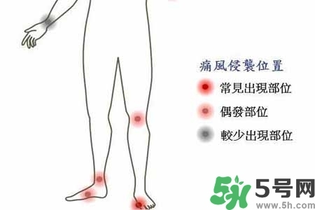 引發(fā)痛風(fēng)的原因是什么？痛風(fēng)病人飲食需注意什么好？