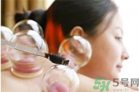 月經(jīng)可以拔火罐嗎？經(jīng)期可以拔火罐嗎？