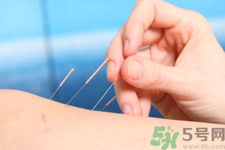 針灸一次要扎多長時(shí)間？針灸可以幾天做一次？
