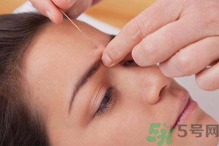 針灸一次要扎多長時(shí)間？針灸可以幾天做一次？